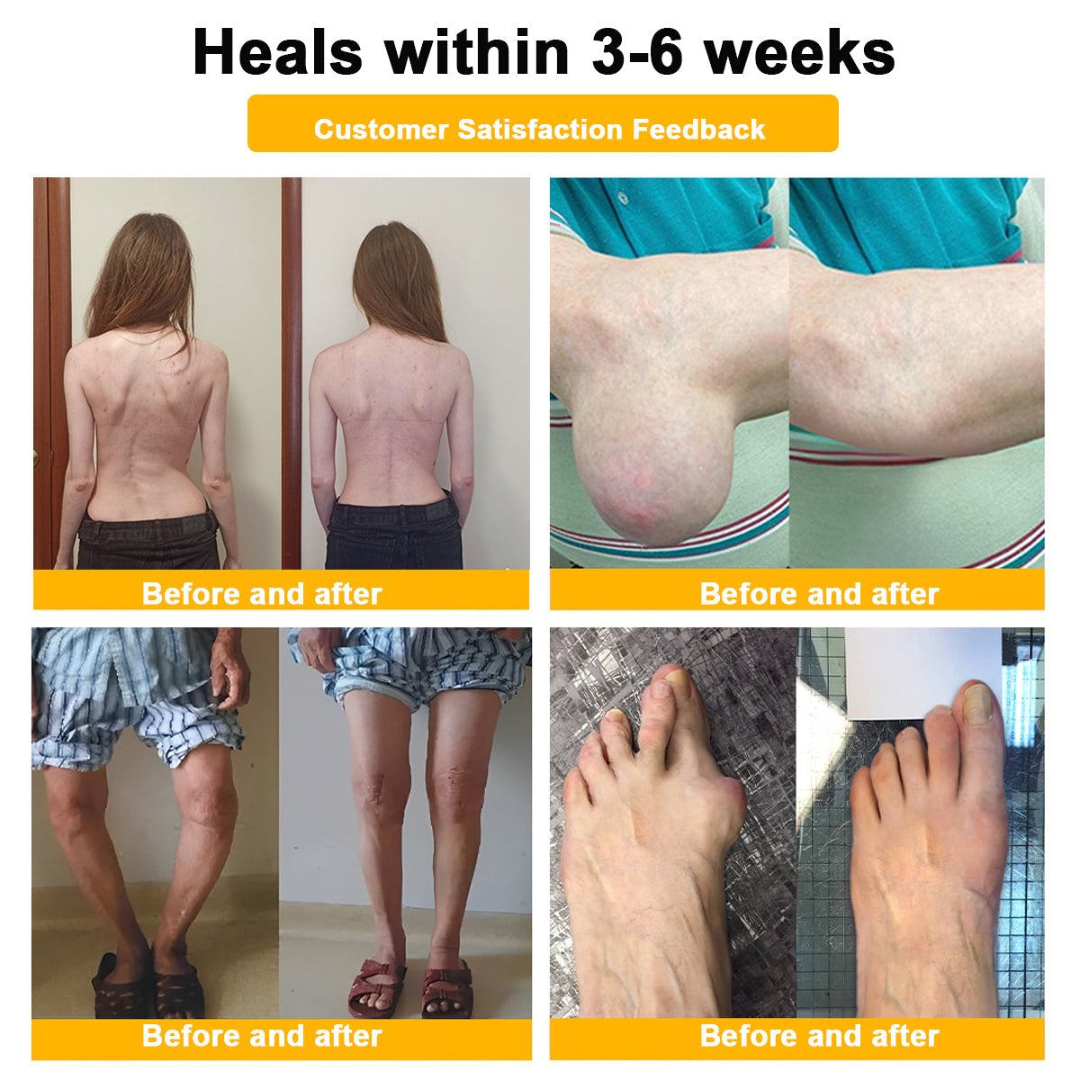 Botulinum Toxine & Bijengif Botgenezing Crème