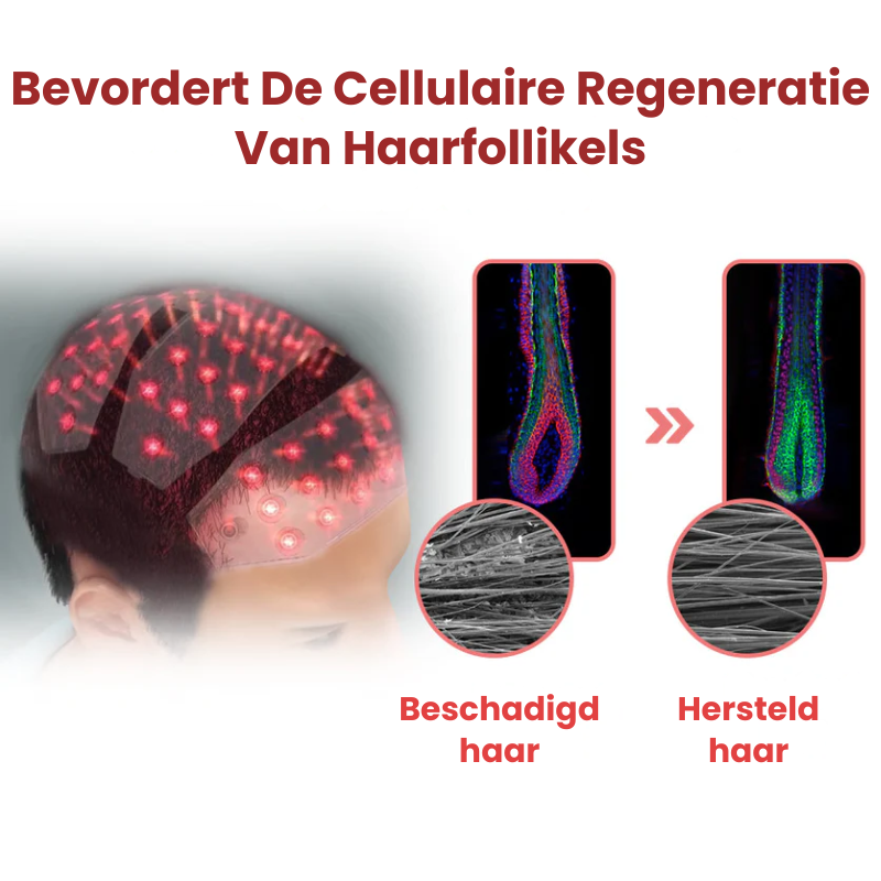 HealthyHair™ | Infrarood Haartherapie Kap