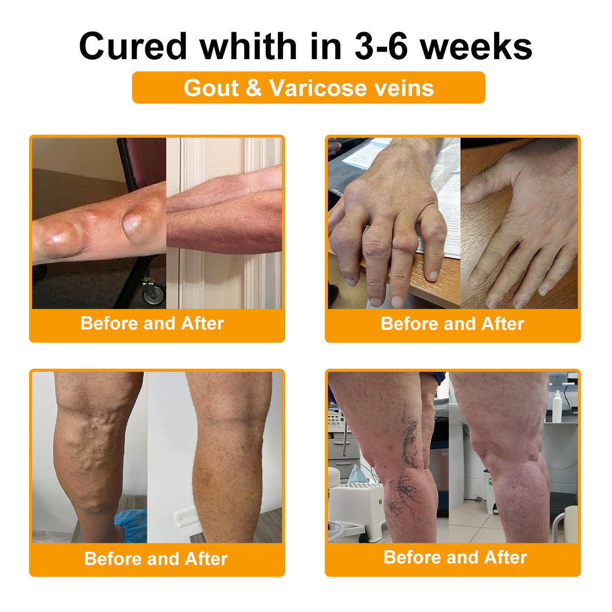 Botulinum Toxine & Bijengif Botgenezing Crème