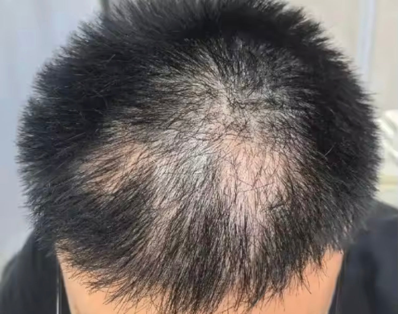 Magic Haar Concealer 2.0 Water- & zweetbestendig💧