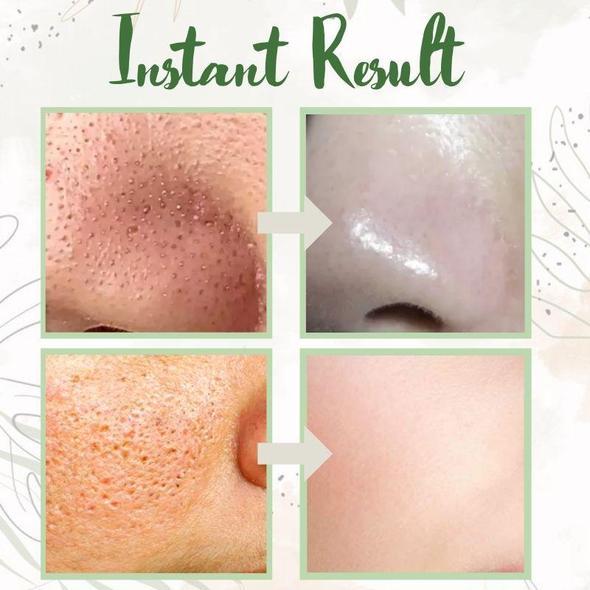 Hydraterende Masker Stick - Diepe Reiniging en Hydratatie