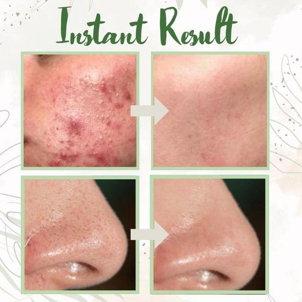 Hydraterende Masker Stick - Diepe Reiniging en Hydratatie