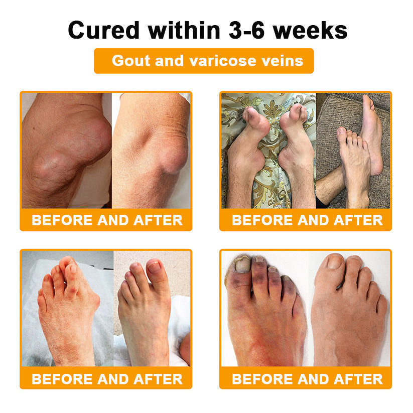 Botulinum Toxine & Bijengif Botgenezing Crème