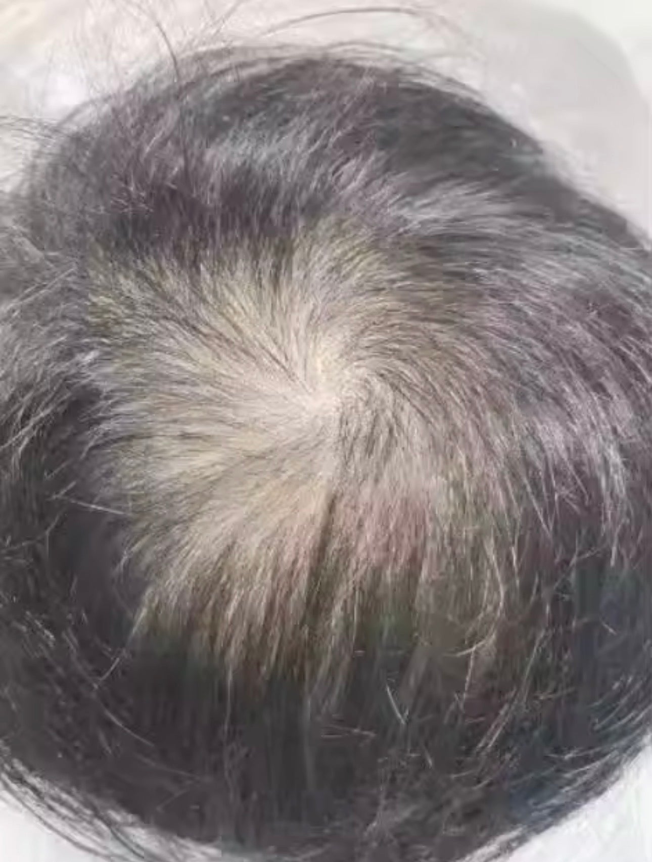 Magic Haar Concealer 2.0 Water- & zweetbestendig💧