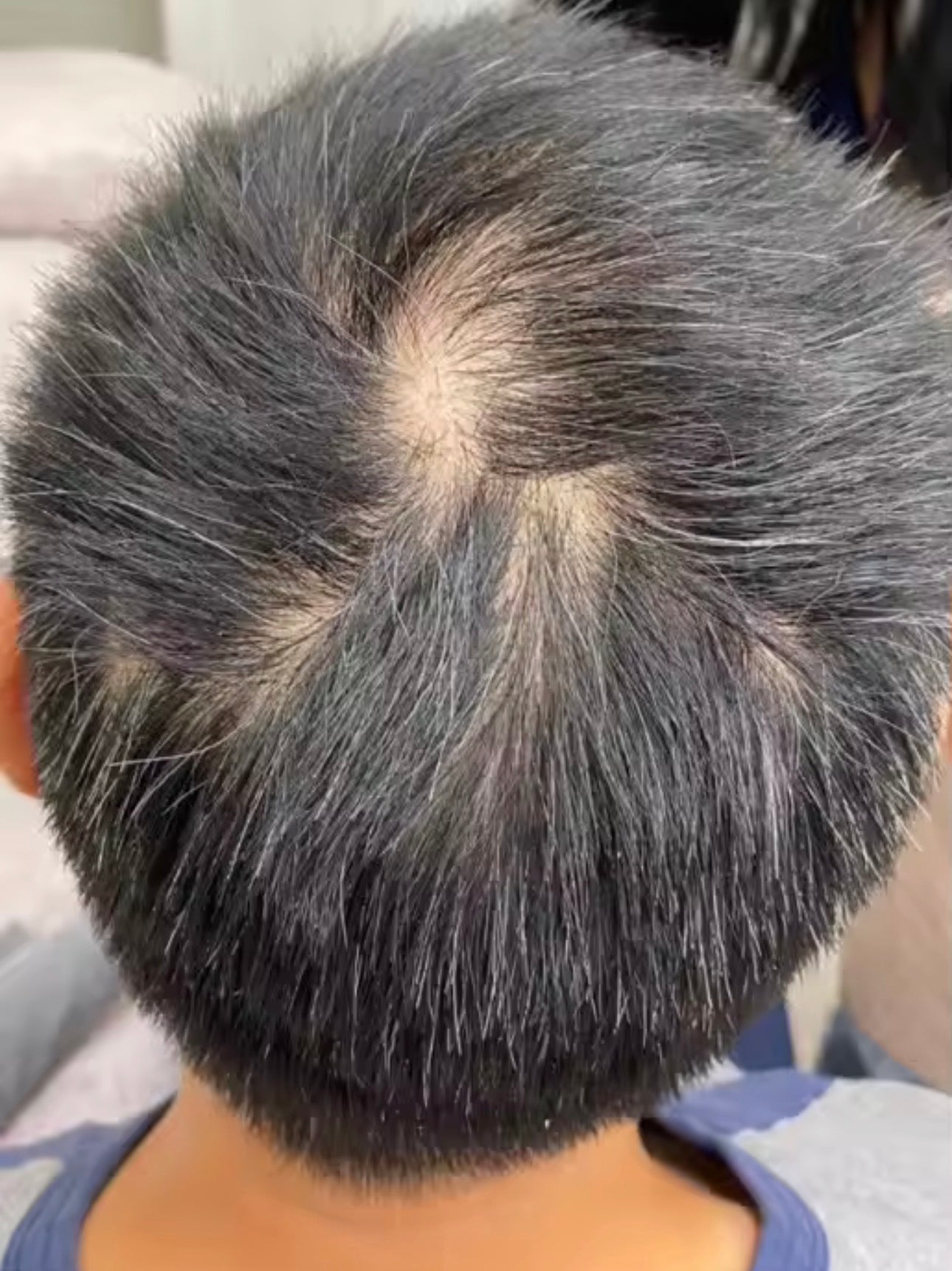 Magic Haar Concealer 2.0 Water- & zweetbestendig💧