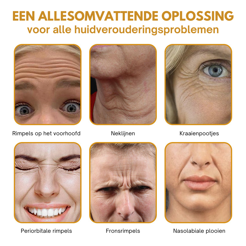 Anti-Rimpels™ | Botox Rimpelverwijdering Crème