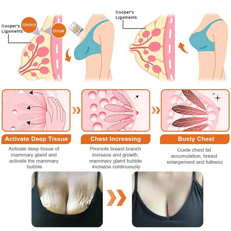 Flysmus™ Botox Bee Venom
