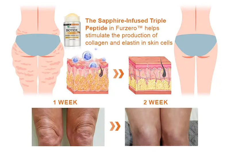 Flysmus™ Botox Bee Venom