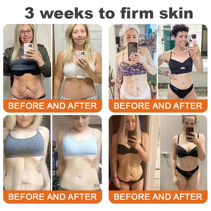 Flysmus™ Botox Bee Venom