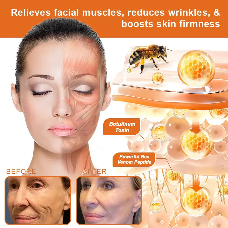Flysmus™ Botox Bee Venom