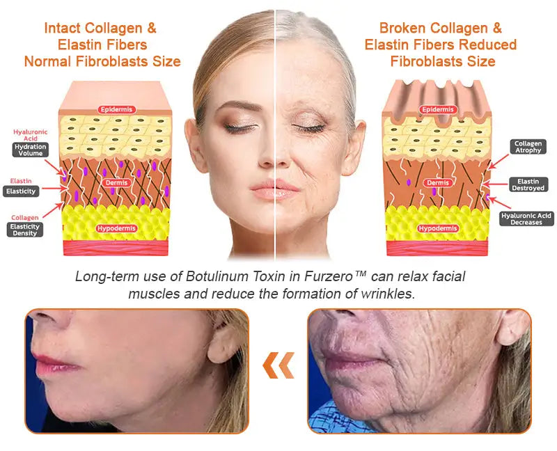 Flysmus™ Botox Bee Venom