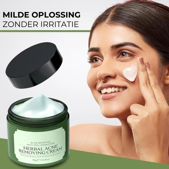 Acne Removing Cream™