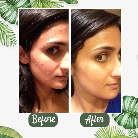 Hydraterende Masker Stick - Diepe Reiniging en Hydratatie