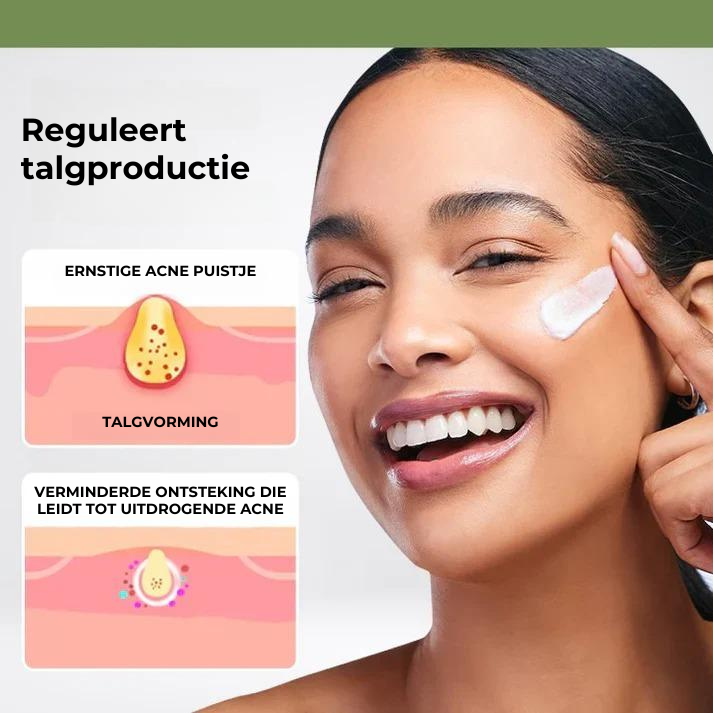 Acne Removing Cream™