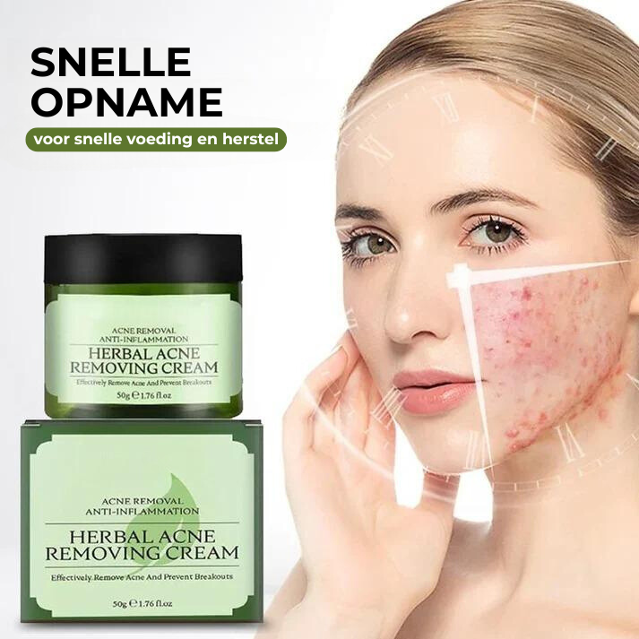 Acne Removing Cream™