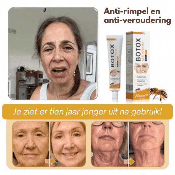 Anti-Rimpels™ | Botox Rimpelverwijdering Crème