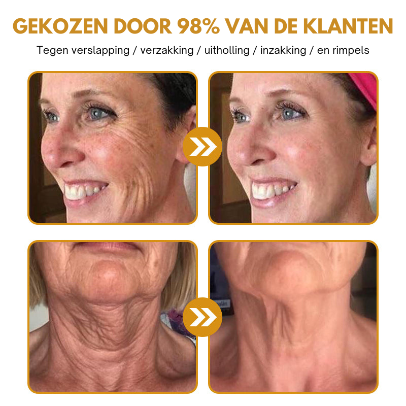 Anti-Rimpels™ | Botox Rimpelverwijdering Crème