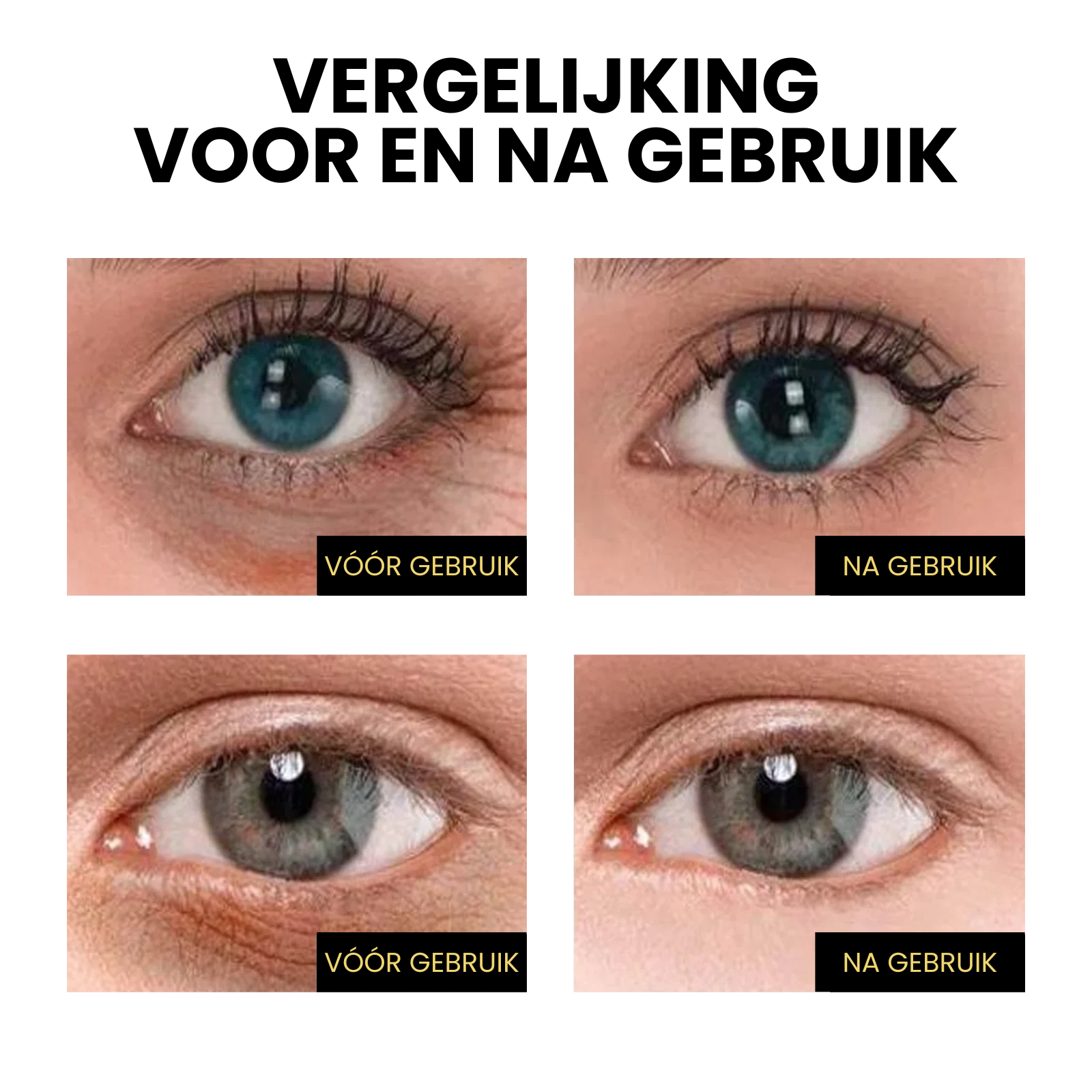 EyeLift™ | Verstevigende Oogcrème