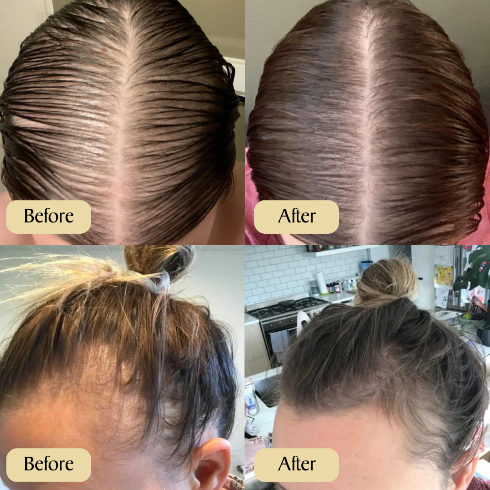 1+1 GRATIS | Veganic™ -Natuurlijke haargroei-olie