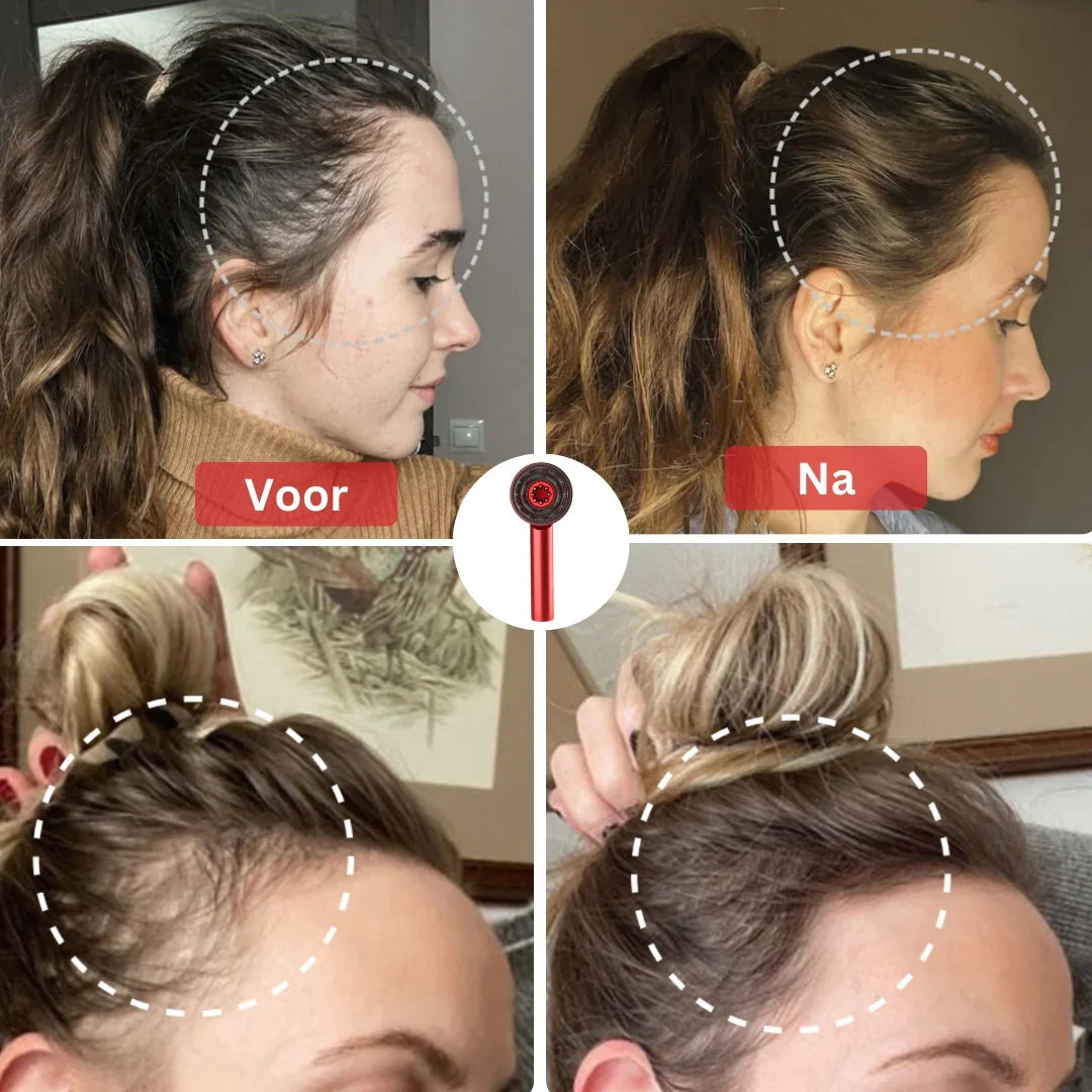 HairMulti Massagekam helpt bij het verminderen van haaruitval en bevordert de haargroei