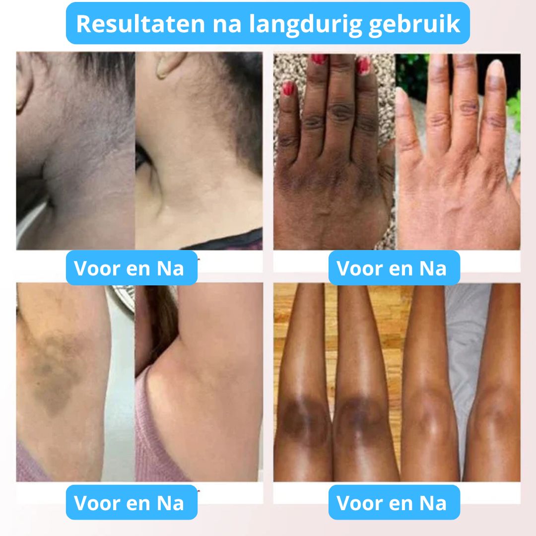 PHANSTA - Lichaam en Gezicht Scrub Gel – Diepe Reiniging en Hydratatie 50ml