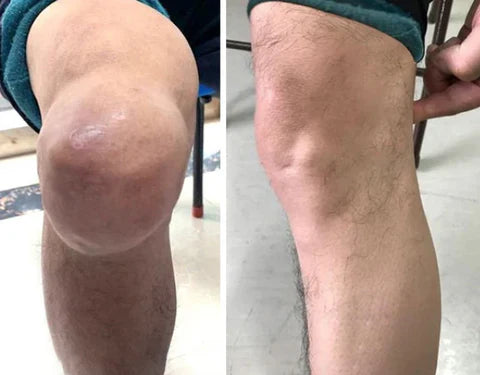 Micronaaldpleister®