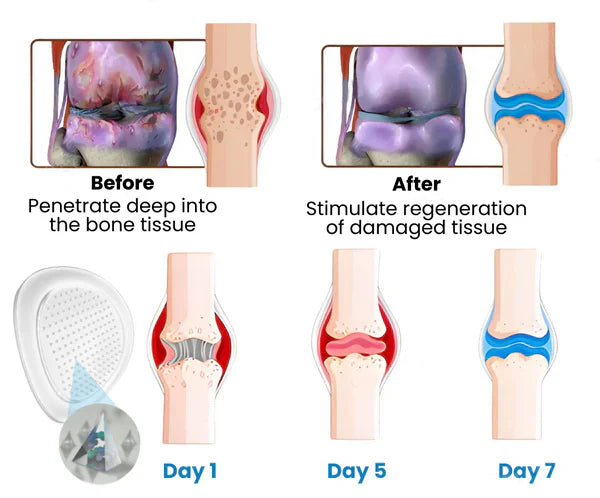 Micronaaldpleister®