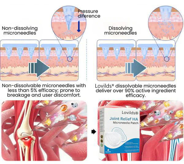 Micronaaldpleister®