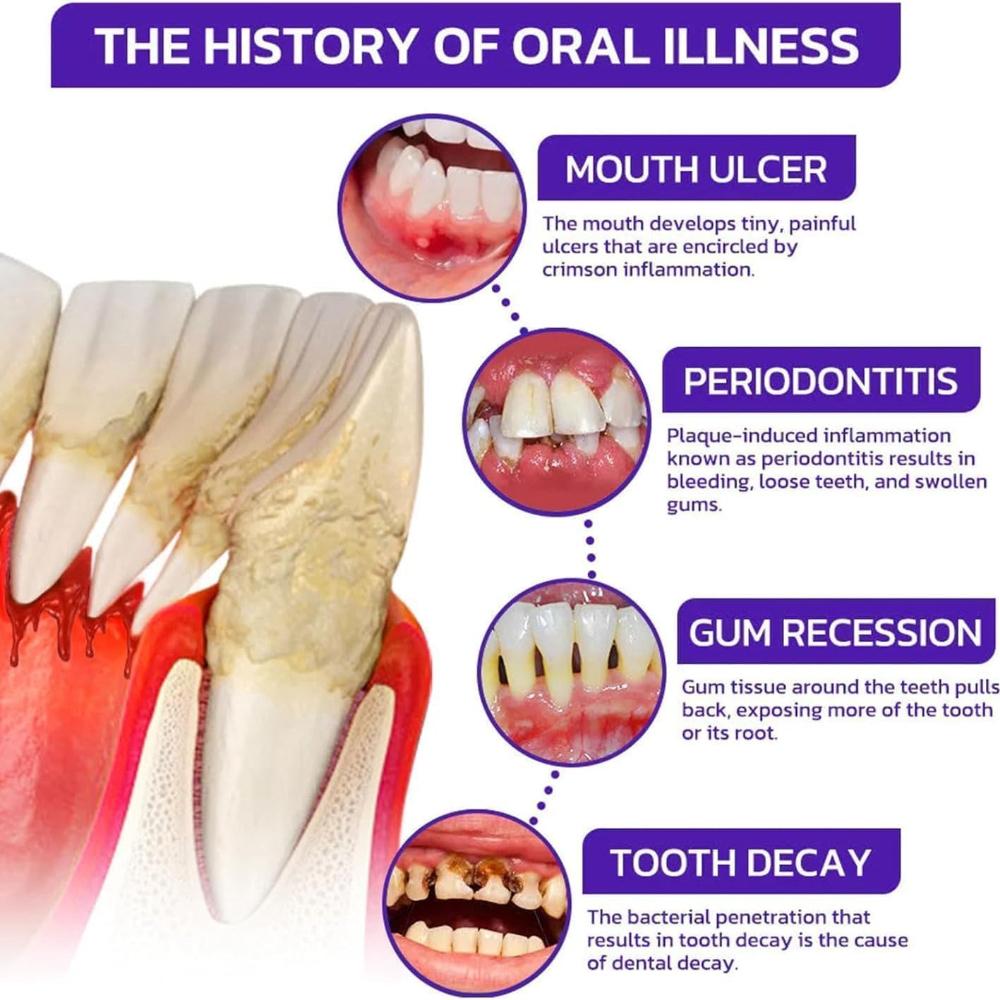 🦷 GUM® Therapie helpt bij het behandelen van parodontitis en gingivitis