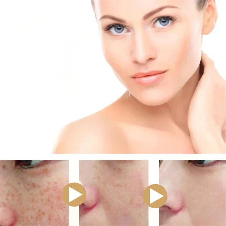 GlowGenix | Kurkumaolie 100% puur voor Donkere Vlekken