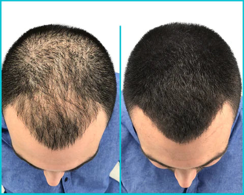 Verônni Haar Concealer