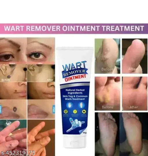 Wart-Remover™ - Wrat Verwijderaar 20ml
