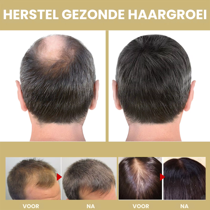HealthyHair™ | Infrarood Haartherapie Kap