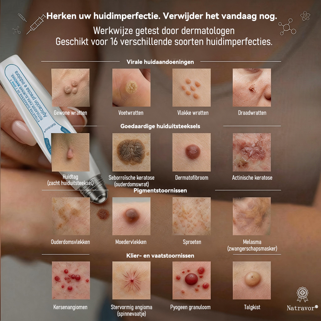 Natravor® 7 Dagen - Wratten- en Bultjesverwijderaar