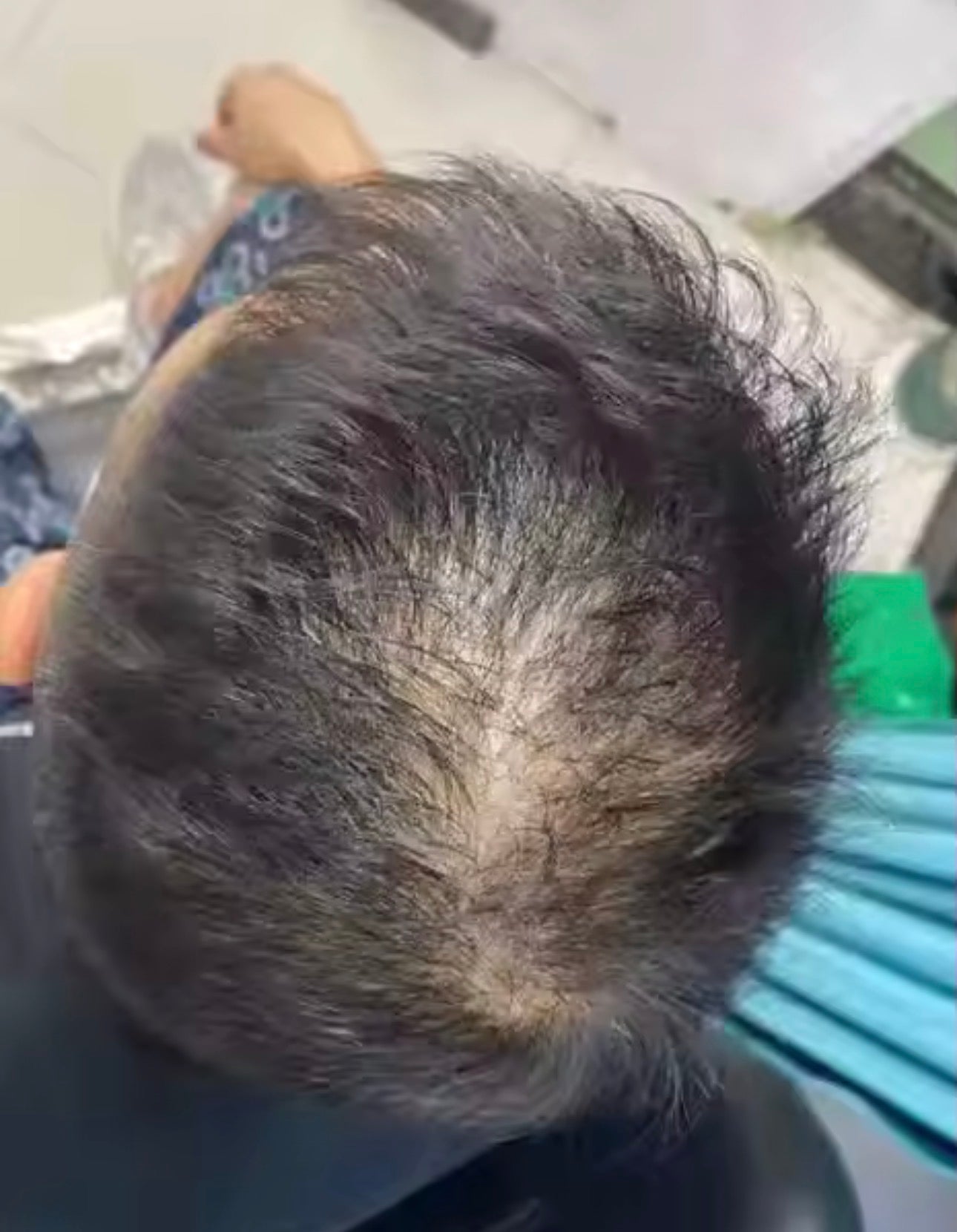 Magic Haar Concealer 2.0 Water- & zweetbestendig💧