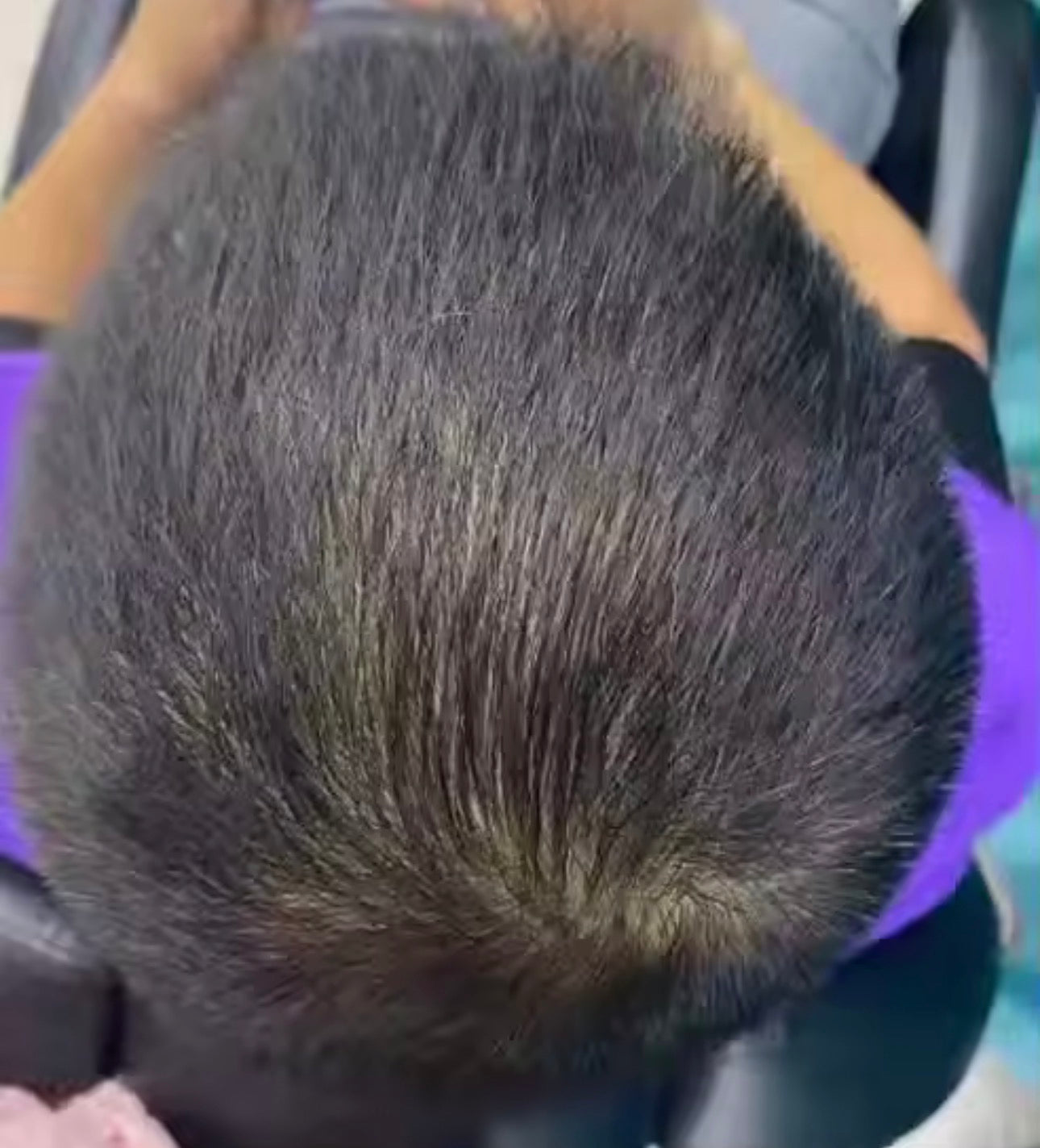 Magic Haar Concealer 2.0 Water- & zweetbestendig💧